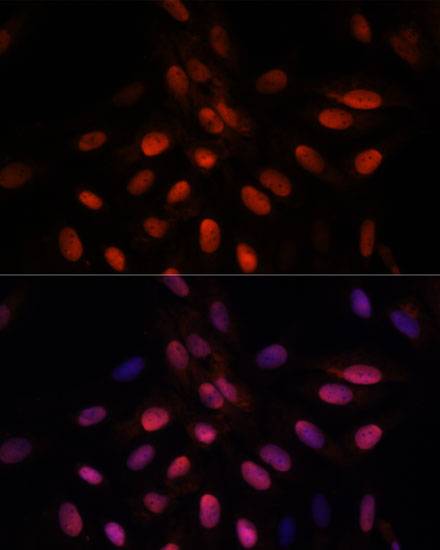 Anti-TPI1 Antibody (CAB15733)