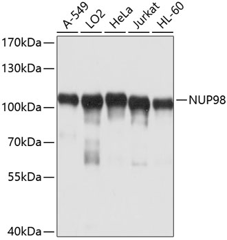 Anti-NUP98 Antibody (CAB0530)