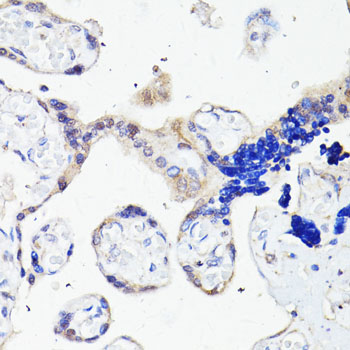 Anti-PLIN3 Antibody (CAB1050)