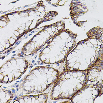 Anti-MMP9 Antibody (CAB11391)