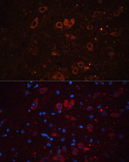 Anti-SLC17A7 Antibody (CAB17188)