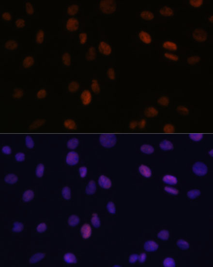 Anti-PSME3 Antibody (CAB12697)