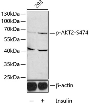 Anti-Phospho-AKT2-S474 Antibody (CABP0005)