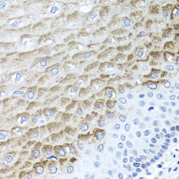 Anti-F3 Antibody (CAB1378)