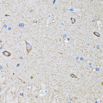 Anti-HIP1 Antibody (CAB6921)