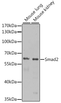 Anti-Smad2 Antibody (CAB11498)