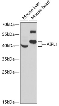 Anti-AIPL1 Antibody (CAB6458)