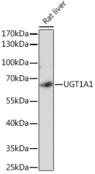 Anti-UGT1A1 Antibody (CAB6186)