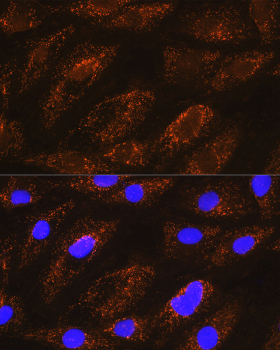 Anti-NDUFA8 Antibody (CAB12118)