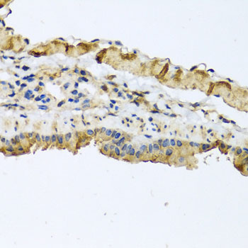 Anti-ATP2C1 Antibody (CAB2515)