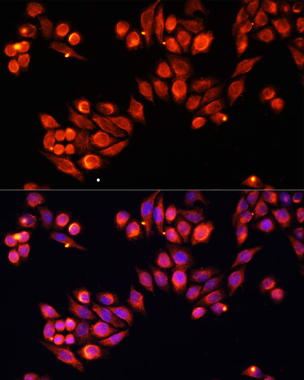 Anti-Heparanase 1 Antibody (CAB16488)