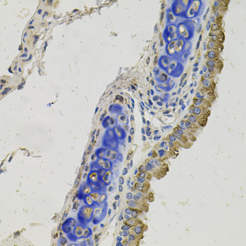 Anti-GAS6 Polyclonal Antibody (CAB8545)