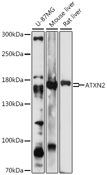 Anti-ATXN2 Antibody (CAB16666)