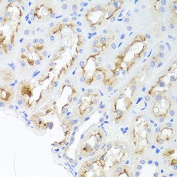 Anti-ADIPOQ Antibody (CAB2543)