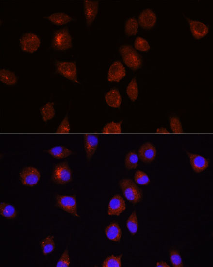 Anti-AKT1 Antibody (CAB5523)