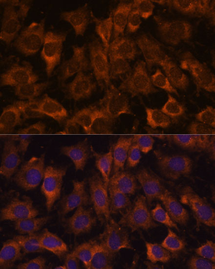 Anti-SEC23B Antibody (CAB15131)