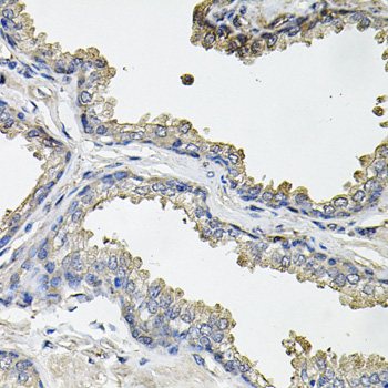 Anti-IREB1 Antibody (CAB7867)