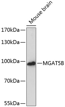 Anti-MGAT5B Antibody (CAB13870)