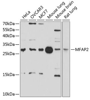 Anti-MFAP2 Antibody (CAB10230)