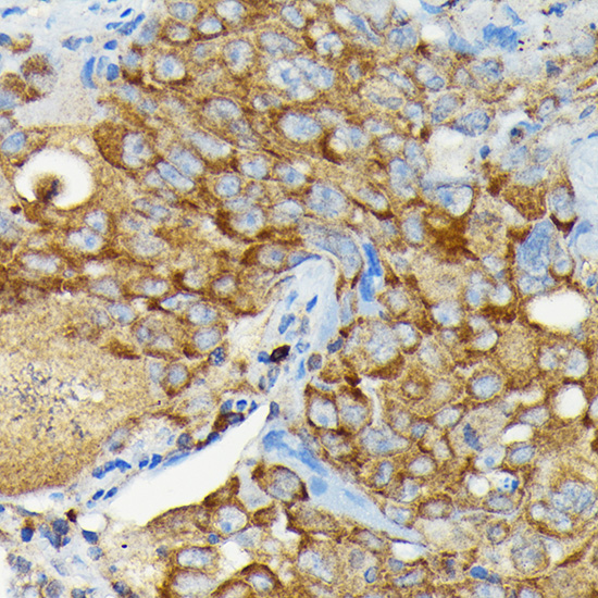 Anti-CYLD Antibody (CAB3821)