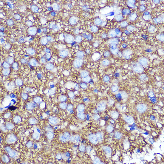 Anti-SNAP25 Antibody (CAB0986)