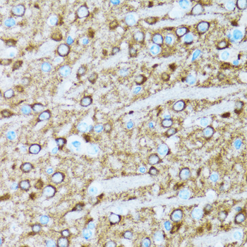 Anti-ENO2 Antibody (CAB3118)