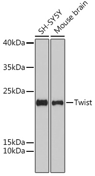 Anti-Twist Antibody [KO Validated] (CAB15596)