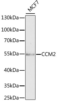 Anti-CCM2 Antibody (CAB6544)