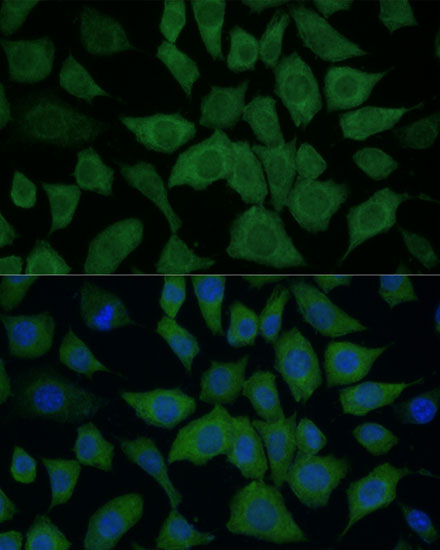 Anti-IDH1 Antibody [KO Validated] (CAB13245)