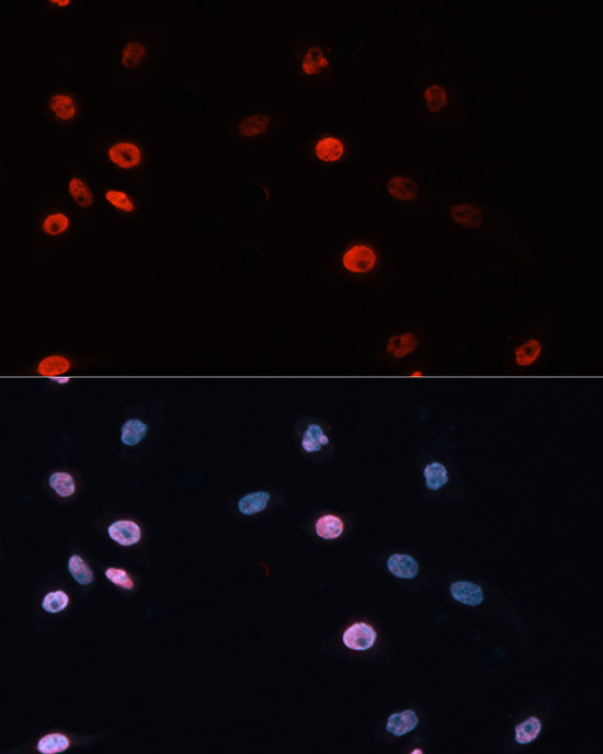 Anti-DNMT3B Antibody (CAB2899)