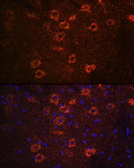 Anti-SLC18A3 Antibody (CAB16068)