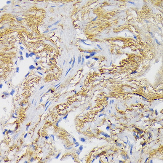 Anti-WNT3A Antibody (CAB0642)