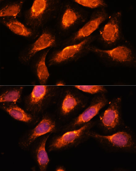 Anti-RAB1A Antibody (CAB17364)