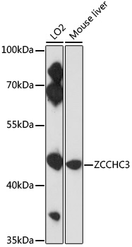 Anti-ZCCHC3 Antibody (CAB17235)