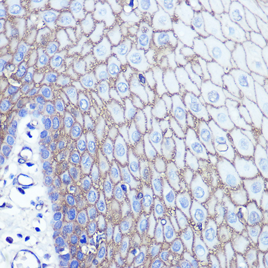 Anti-S100A14 Antibody (CAB10394)