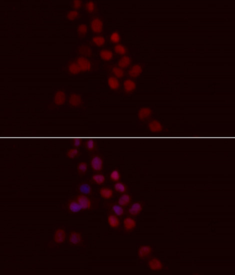 Anti-Histone H1.0 Antibody [KO Validated] (CAB3298)