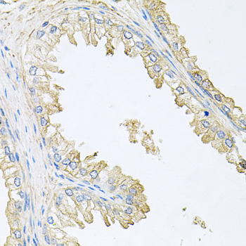 Anti-PPP3R1 Antibody (CAB0954)