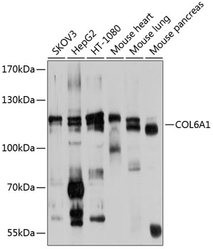 Anti-COL6A1 Polyclonal Antibody (CAB9236)