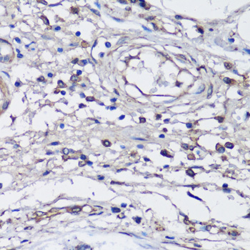 Anti-NLRC4 Antibody (CAB13117)