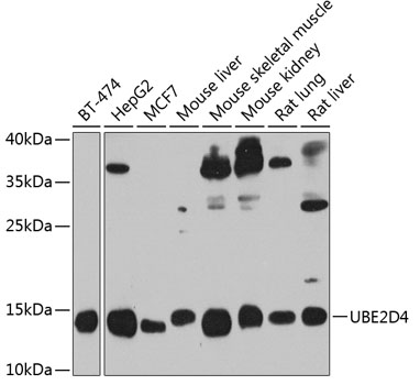 Anti-UBE2D4 Polyclonal Antibody (CAB8332)