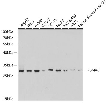 Anti-PSMA6 Antibody (CAB13536)
