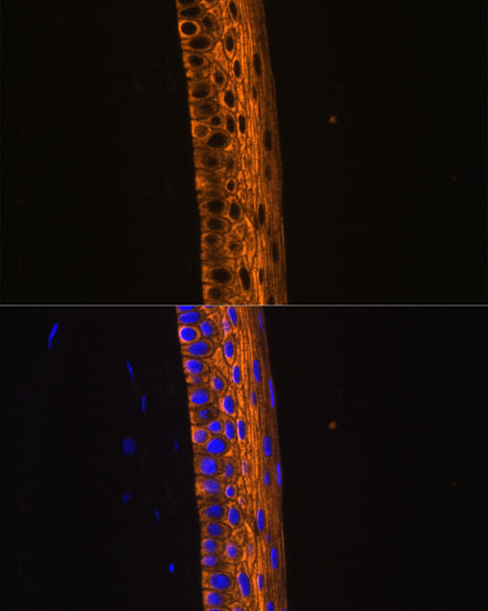 Anti-MYH13 Antibody (CAB14620)