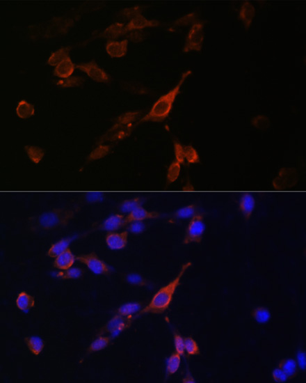 Anti-RAB21 Antibody (CAB12095)