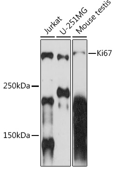 Anti-Ki67 Antibody (CAB2094)