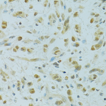 Anti-RCC1 Antibody (CAB6350)