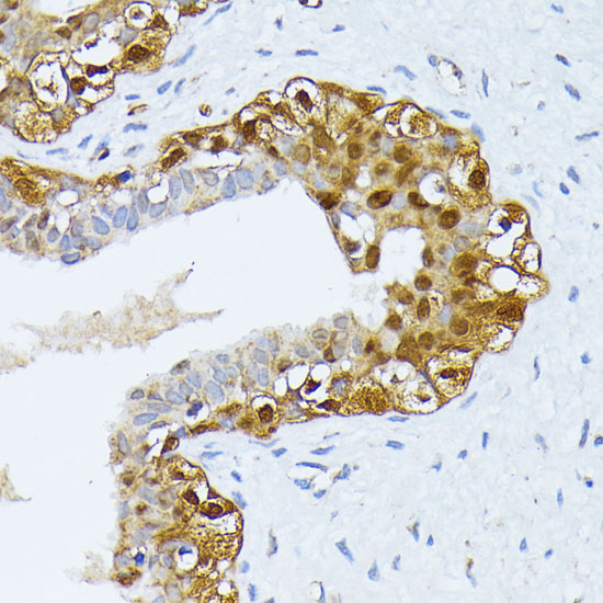 Anti-SMN1 Antibody (CAB16246)