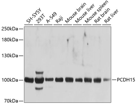 Anti-PCDH15 Antibody (CAB10086)