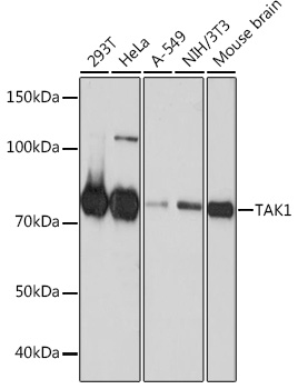 Anti-TAK1 Antibody (CAB19077)