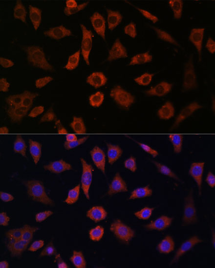 Anti-CYTH1 Antibody (CAB15351)