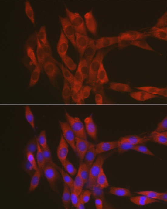 Anti-RhoA Antibody (CAB0272)